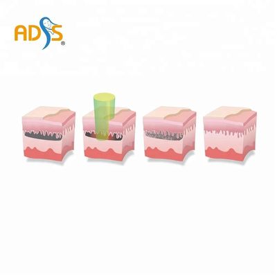 เครื่องเลเซอร์ ND Yag แนวตั้ง เครื่องกำจัดขนด้วยเลเซอร์และเครื่องกำจัดรอยสัก ISO13485