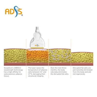 เครื่องกระชับสัดส่วน Cryolipolysis 1060nm 4 จับเครื่องกระชับสัดส่วนเลเซอร์ไดโอด