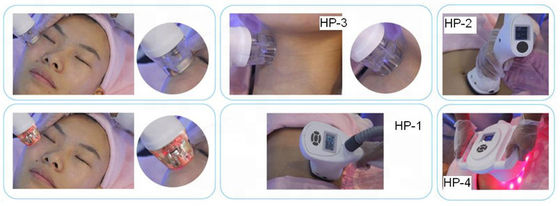 เครื่องกระชับสัดส่วน VELA-SHAPE ยกกระชับใบหน้า 2000W Cavitation RF เครื่องสูญญากาศ
