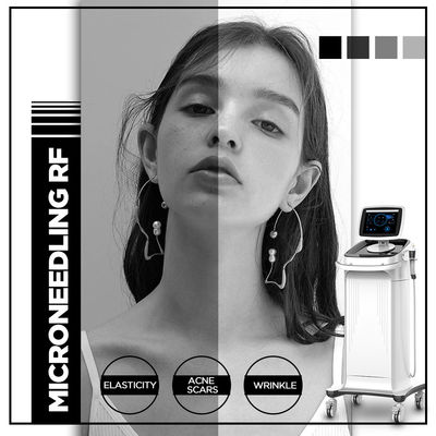 เครื่อง Microneedling ความถี่วิทยุ, เครื่อง Thermolift สำหรับร้านสปา